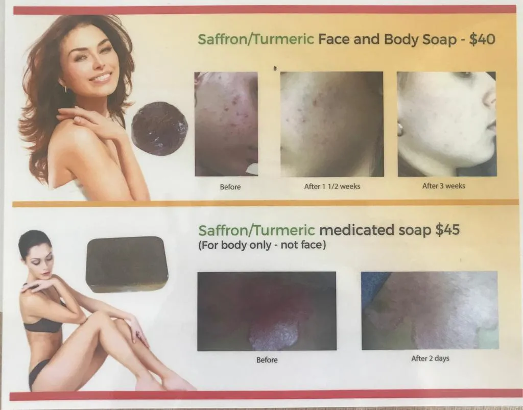 Soap - Turmeric - Face and Body soap